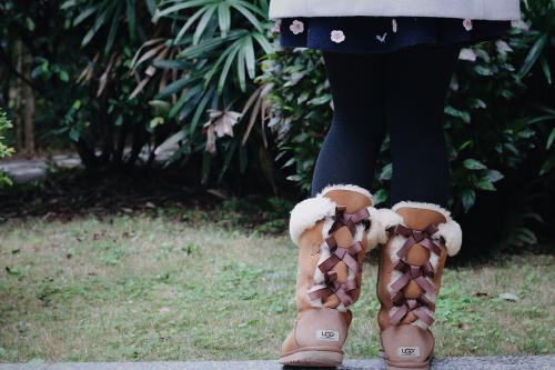 Az Ugg csizmák veszélyei: divatos, de problémás viselet?
